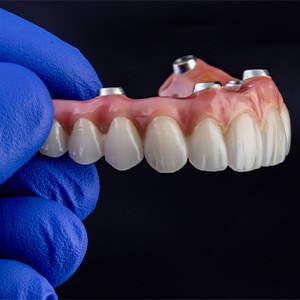 An implant denture