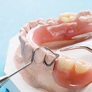 a partial denture on a plaster mold of a mouth