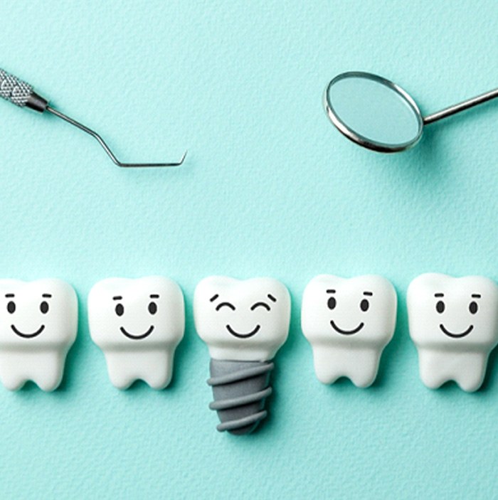 Illustration of a happy dental implant