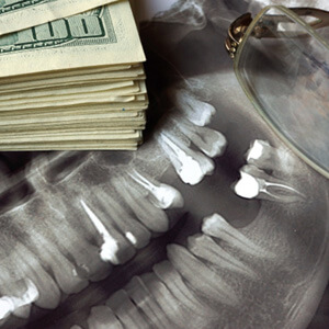 dental xray with a pile of money on it 